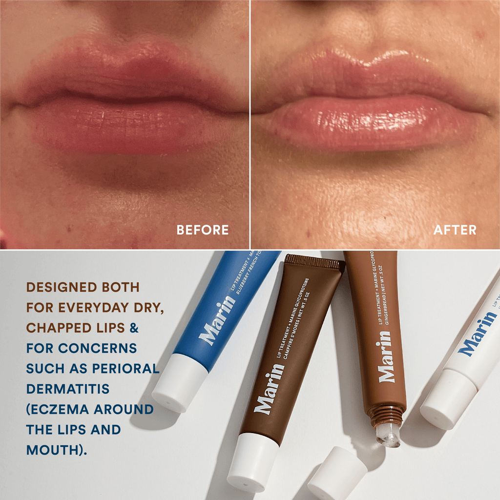 Lip Treatment