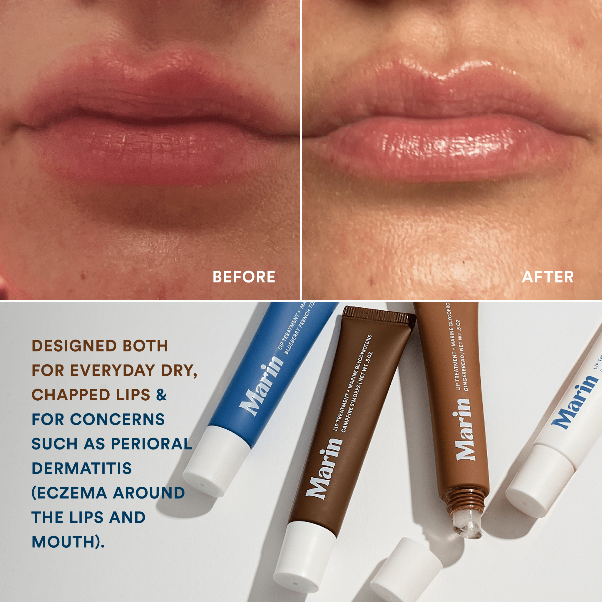 Lip Treatment
